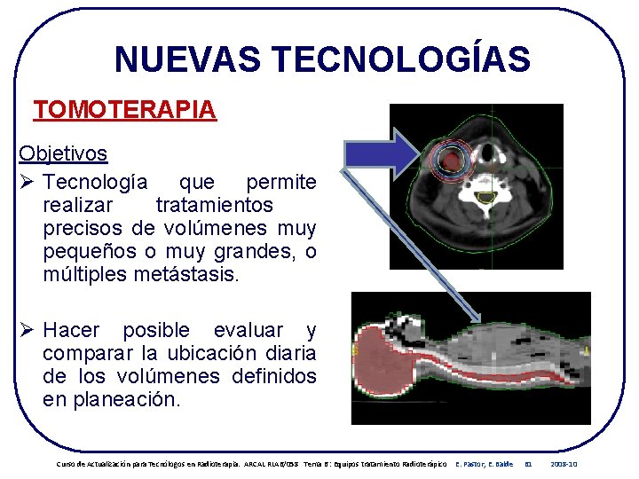 NUEVAS TECNOLOGÍAS TOMOTERAPIA Objetivos Ø Tecnología que permite realizar tratamientos precisos de volúmenes muy NUEVAS TECNOLOGÍAS TOMOTERAPIA Objetivos Ø Tecnología que permite realizar tratamientos precisos de volúmenes muy