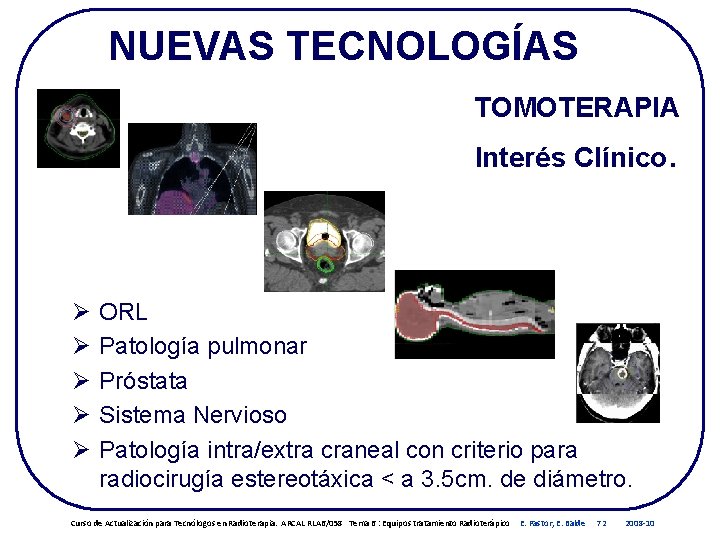 NUEVAS TECNOLOGÍAS TOMOTERAPIA Interés Clínico. Ø Ø Ø ORL Patología pulmonar Próstata Sistema Nervioso NUEVAS TECNOLOGÍAS TOMOTERAPIA Interés Clínico. Ø Ø Ø ORL Patología pulmonar Próstata Sistema Nervioso