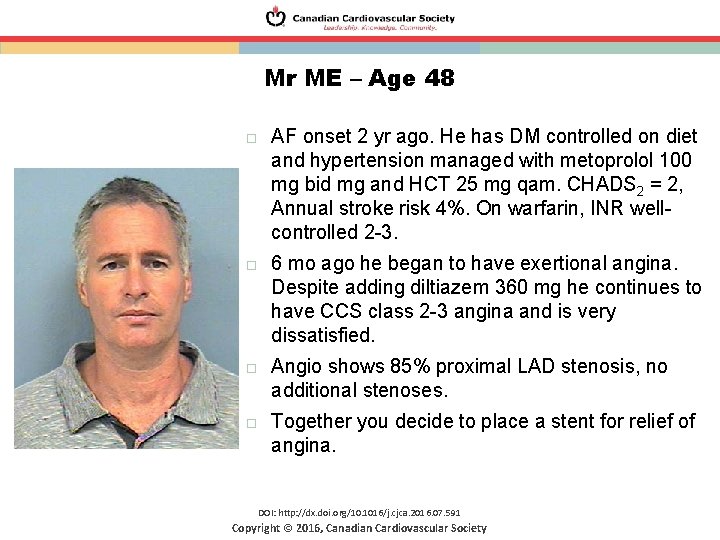 Mr ME – Age 48 AF onset 2 yr ago. He has DM controlled