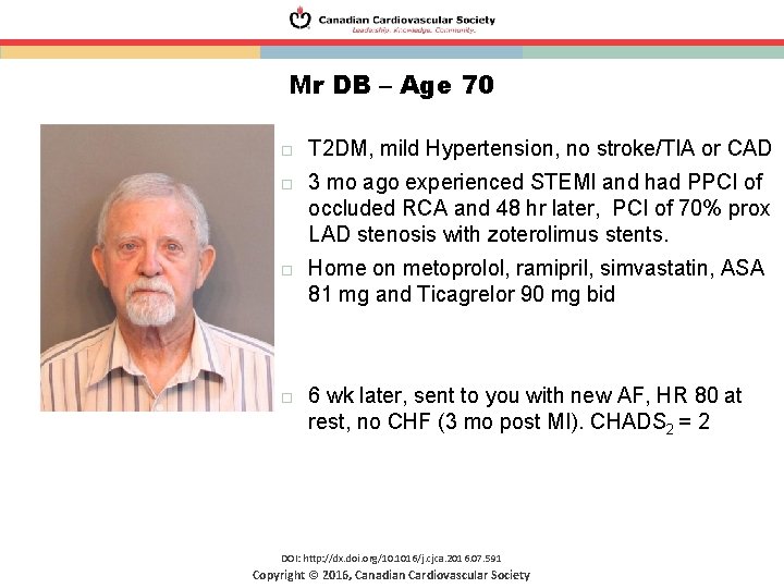 Mr DB – Age 70 T 2 DM, mild Hypertension, no stroke/TIA or CAD