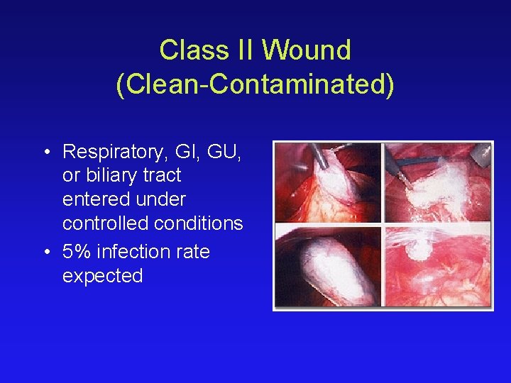 Class II Wound (Clean-Contaminated) • Respiratory, GI, GU, or biliary tract entered under controlled