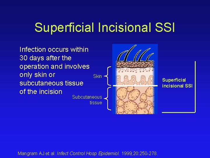 Superficial Incisional SSI Infection occurs within 30 days after the operation and involves only