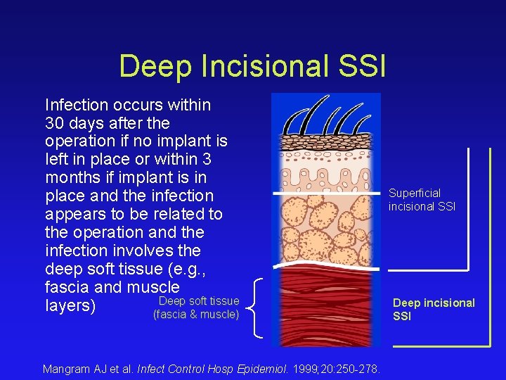 Deep Incisional SSI Infection occurs within 30 days after the operation if no implant