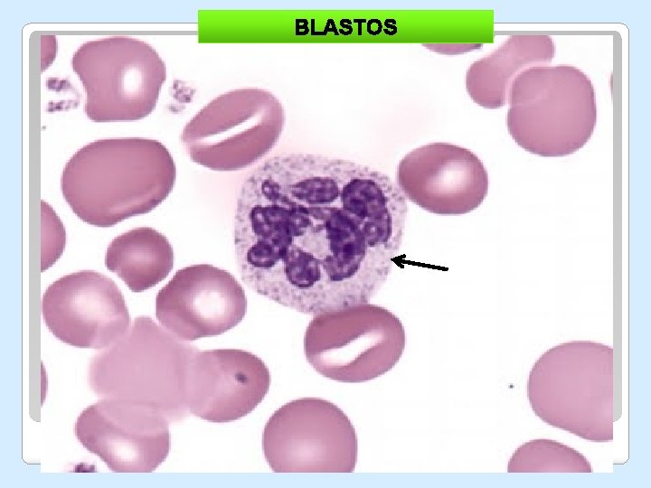 BLASTOS BLASTOS