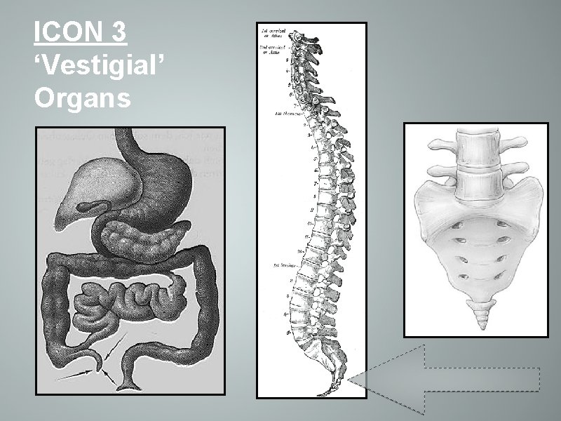 ICON 3 ‘Vestigial’ Organs 