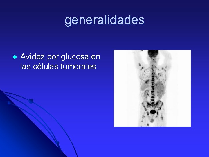 generalidades l Avidez por glucosa en las células tumorales 
