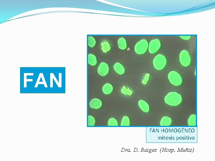 FAN HOMOGÉNEO mitosis positiva Dra. D. Baiges (Hosp. Muñiz) 