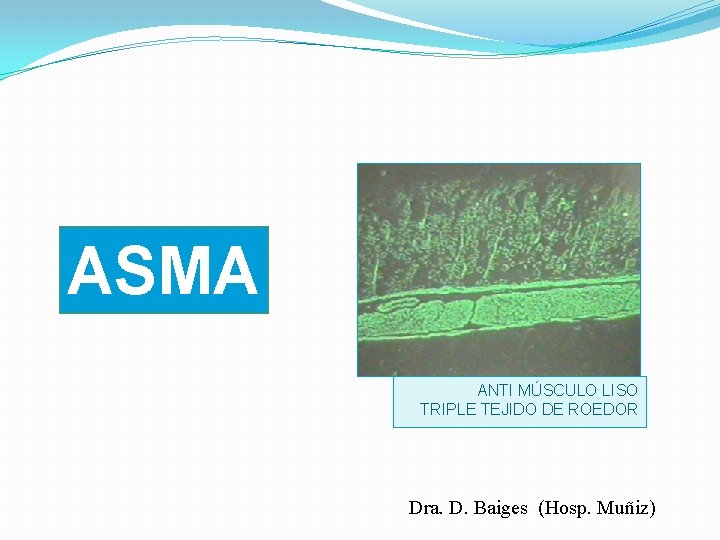 ASMA ANTI MÚSCULO LISO TRIPLE TEJIDO DE ROEDOR Dra. D. Baiges (Hosp. Muñiz) 