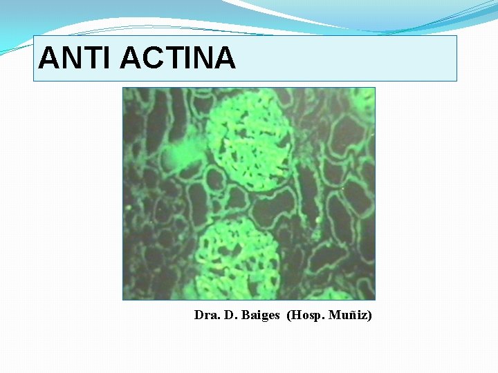 ANTI ACTINA Dra. D. Baiges (Hosp. Muñiz) 
