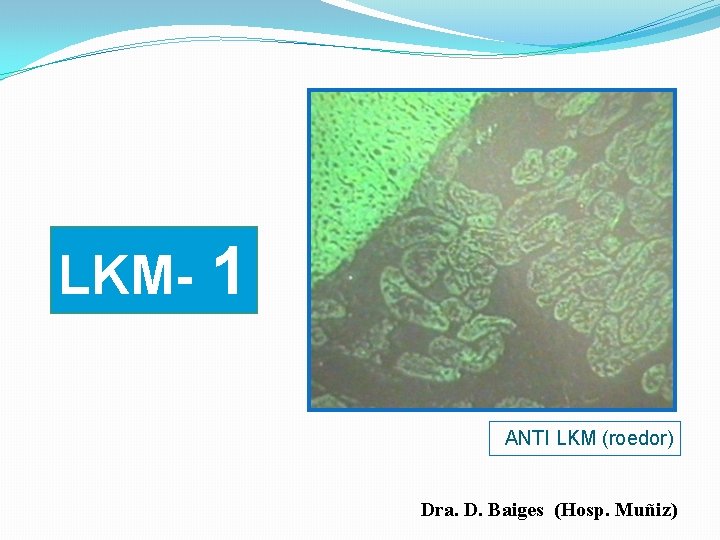 LKM- 1 ANTI LKM (roedor) Dra. D. Baiges (Hosp. Muñiz) 