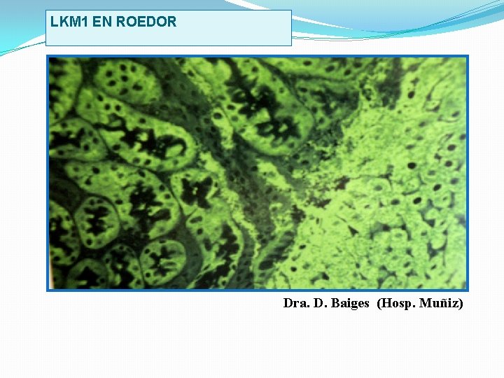 LKM 1 EN ROEDOR Dra. D. Baiges (Hosp. Muñiz) 