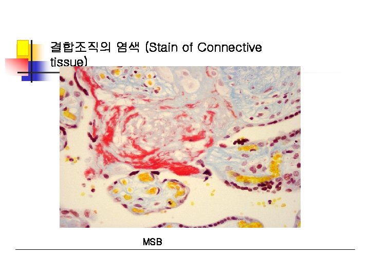 결합조직의 염색 (Stain of Connective tissue) MSB 