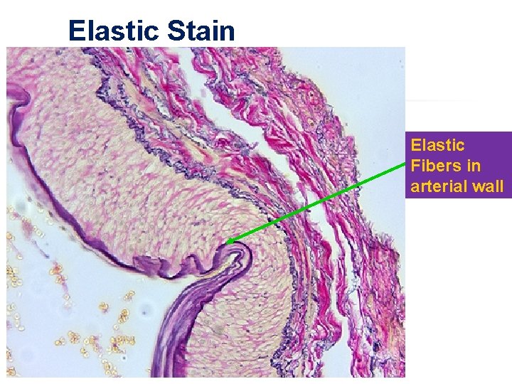 Elastic Stain Elastic Fibers in arterial wall 