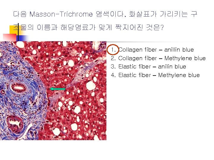 다음 Masson-Trichrome 염색이다. 화살표가 가리키는 구 조물의 이름과 해당염료가 맞게 짝지어진 것은? 1. 2.