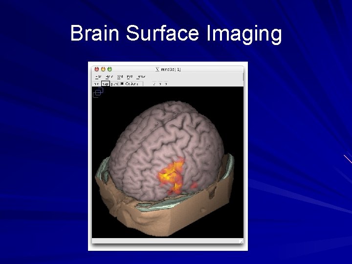 Brain Surface Imaging 