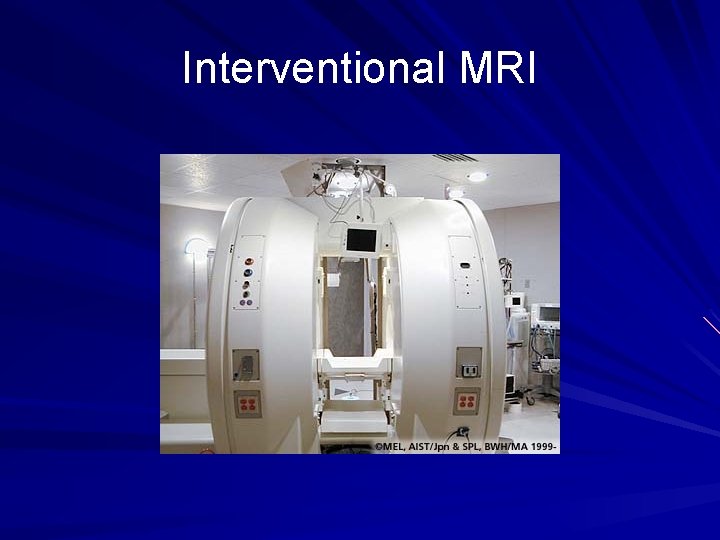 Interventional MRI 