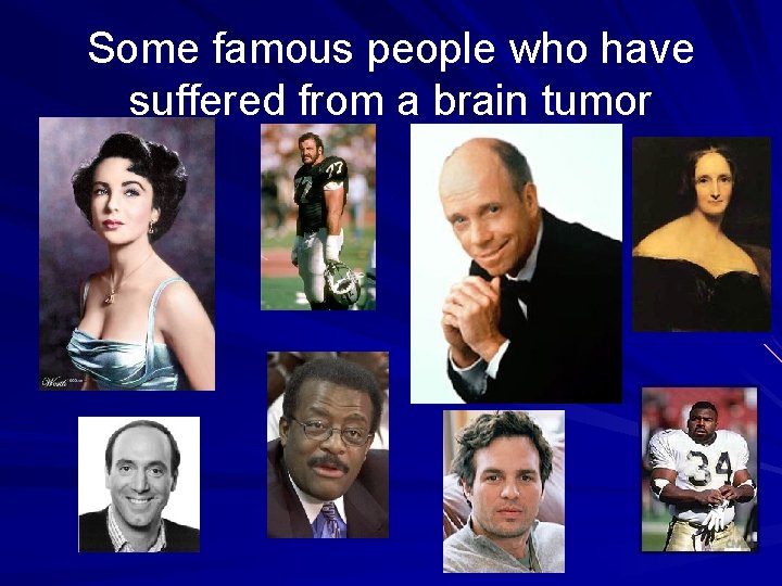 Some famous people who have suffered from a brain tumor 