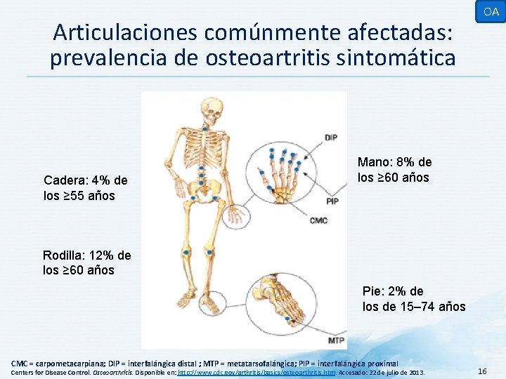 Articulaciones comúnmente afectadas: prevalencia de osteoartritis sintomática Cadera: 4% de los ≥ 55 años