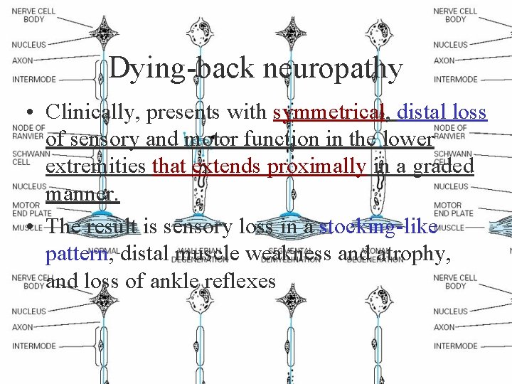 Dying-back neuropathy • Clinically, presents with symmetrical, distal loss of sensory and motor function