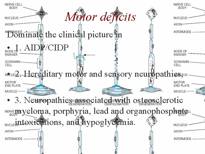 Motor deficits Dominate the clinical picture in • 1. AIDP/CIDP • 2. Hereditary motor