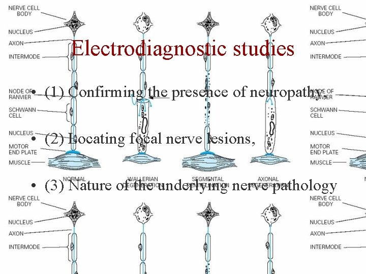 Electrodiagnostic studies • (1) Confirming the presence of neuropathy, • (2) Locating focal nerve