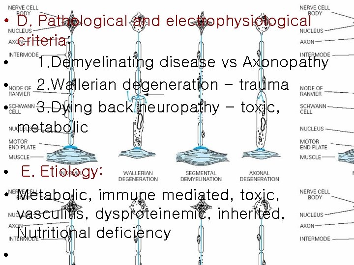  • D. Pathological and electrophysiological criteria: • 1. Demyelinating disease vs Axonopathy •