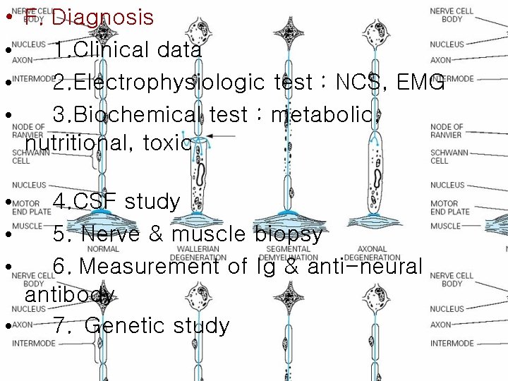  • • F. Diagnosis 1. Clinical data 2. Electrophysiologic test : NCS, EMG