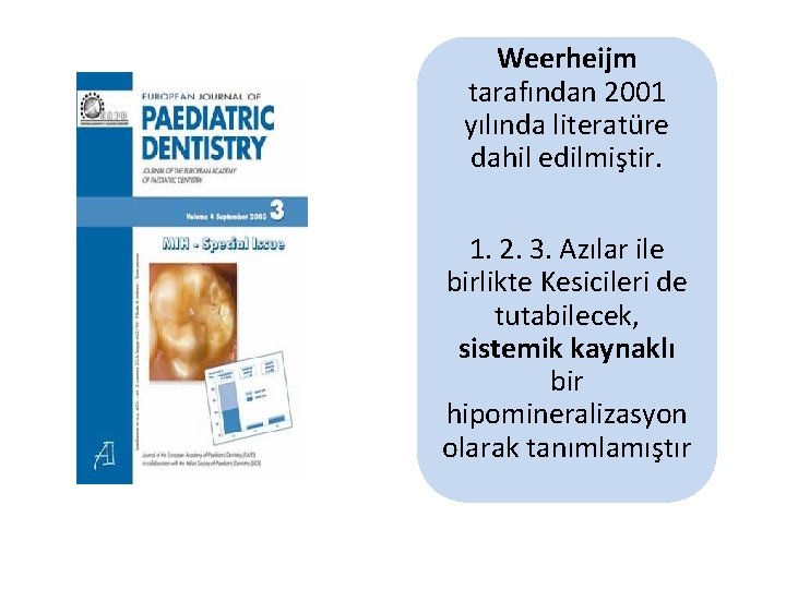 Weerheijm tarafından 2001 yılında literatüre dahil edilmiştir. 1. 2. 3. Azılar ile birlikte Kesicileri