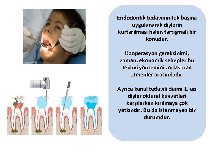 Endodontik tedavinin tek başına uygulanarak dişlerin kurtarılması halen tartışmalı bir konudur. Kooperasyon gereksinimi, zaman,