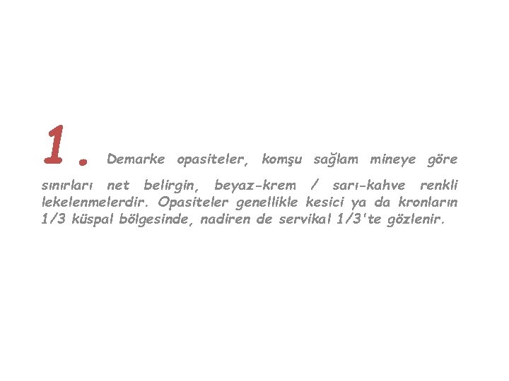 1. Demarke opasiteler, komşu sağlam mineye göre sınırları net belirgin, beyaz-krem / sarı-kahve renkli