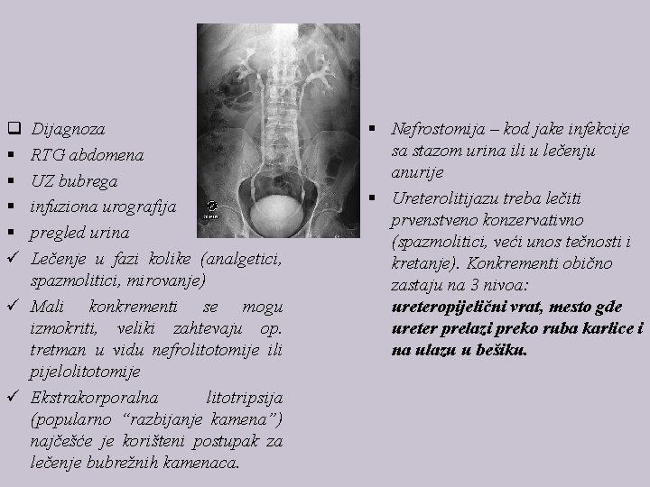 q § § ü Dijagnoza RTG abdomena UZ bubrega infuziona urografija pregled urina Lečenje