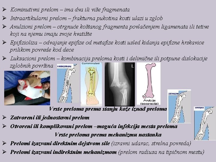 Ø Kominutivni prelom – ima dva ili više fragmenata Ø Intraartikularni prelom – frakturna