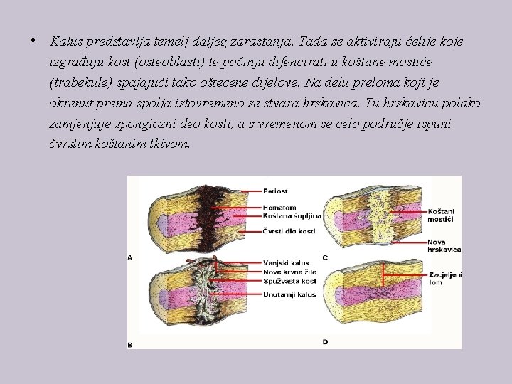  • Kalus predstavlja temelj daljeg zarastanja. Tada se aktiviraju ćelije koje izgrađuju kost