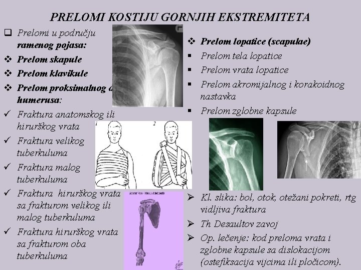 PRELOMI KOSTIJU GORNJIH EKSTREMITETA q Prelomi u području ramenog pojasa: v Prelom skapule v