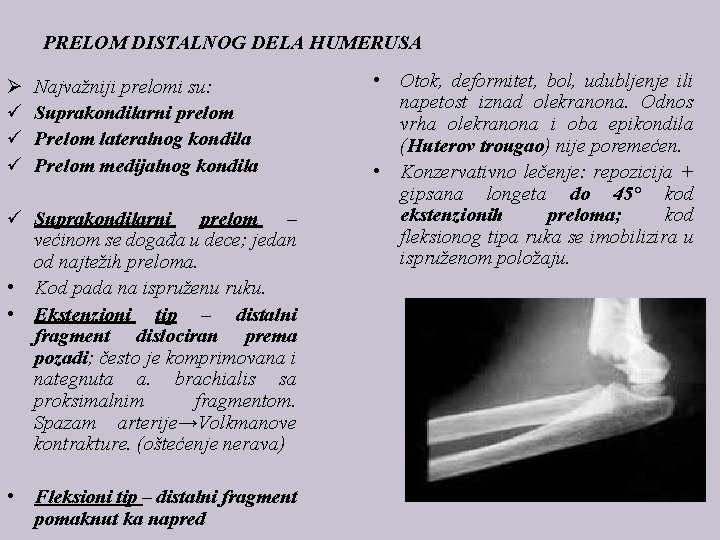 PRELOM DISTALNOG DELA HUMERUSA Ø ü ü ü Najvažniji prelomi su: Suprakondilarni prelom Prelom