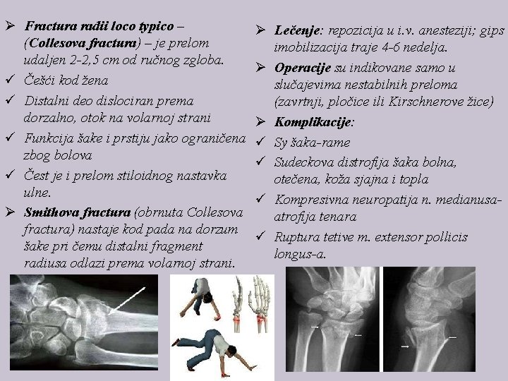 Ø Fractura radii loco typico – (Collesova fractura) – je prelom udaljen 2 -2,