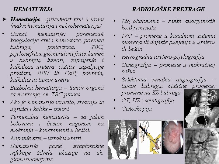 HEMATURIJA Ø Hematurija – prisutnost krvi u urinu /makrohematurija i mikrohematurija/ • Uzroci hematurije: