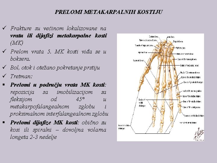 PRELOMI METAKARPALNIH KOSTIJU ü Frakture su većinom lokalizovane na vratu ili dijafizi metakarpalne kosti