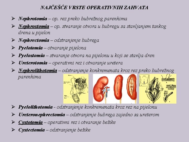 NAJČEŠĆE VRSTE OPERATIVNIH ZAHVATA Ø Nephrotomia – op. rez preko bubrežnog parenhima Ø Nephrostomia
