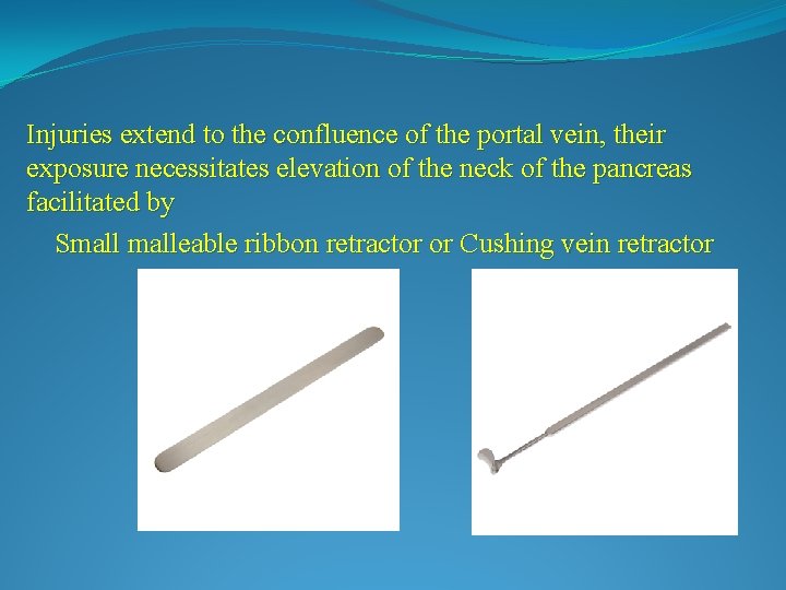 Injuries extend to the confluence of the portal vein, their exposure necessitates elevation of