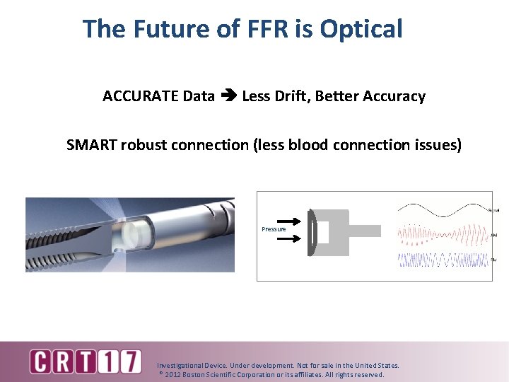 The Future of FFR is Optical ACCURATE Data Less Drift, Better Accuracy SMART robust