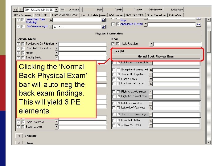 Clicking the ‘Normal Back Physical Exam’ bar will auto neg the back exam findings.