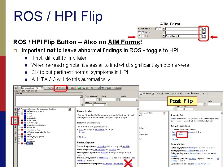 ROS / HPI Flip AIM Form ROS / HPI Flip Button – Also on