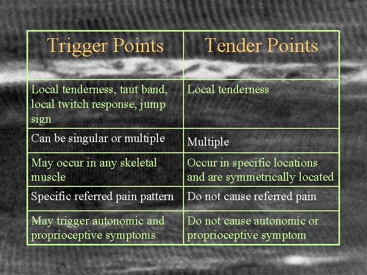 Trigger Points Tender Points Local tenderness, taut band, local twitch response, jump sign Local