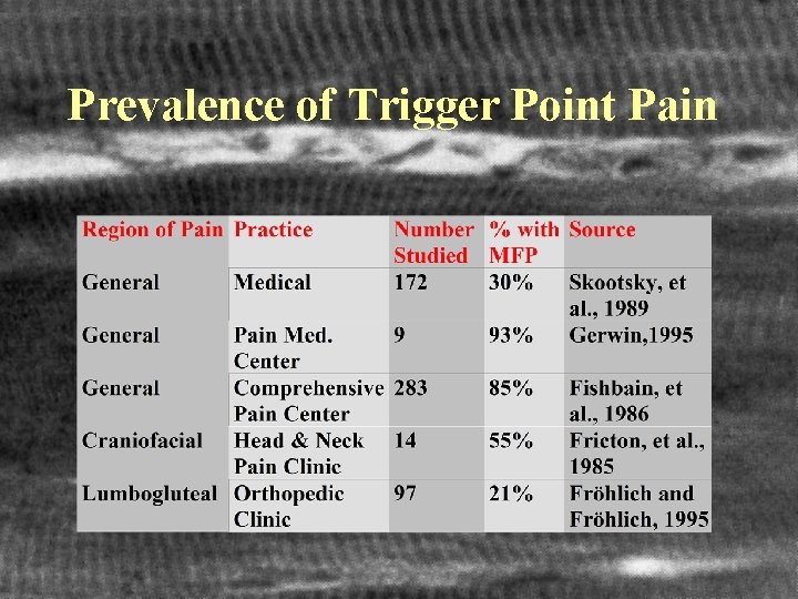 Prevalence of Trigger Point Pain 