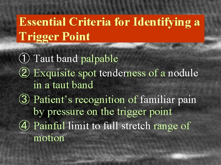 Essential Criteria for Identifying a Trigger Point ① Taut band palpable ② Exquisite spot