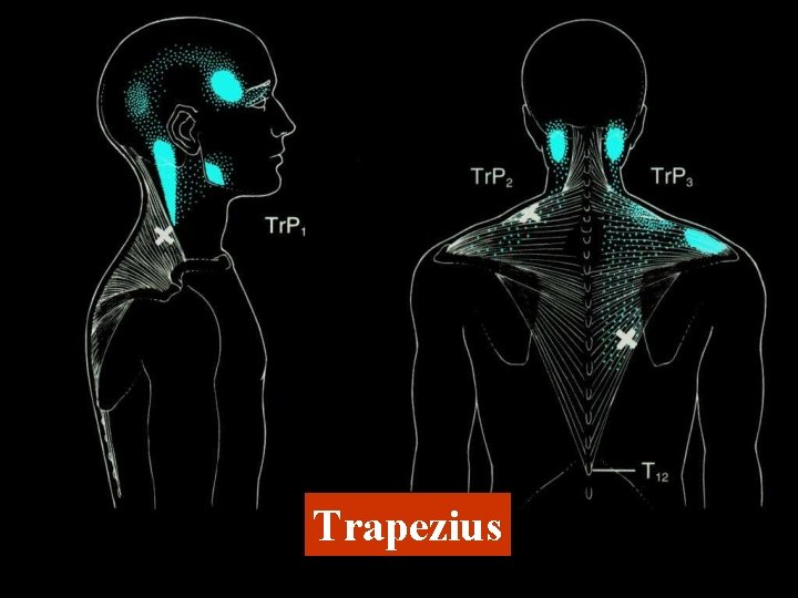 Trapezius 