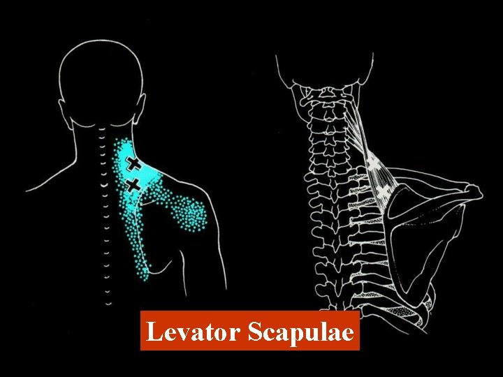 Levator Scapulae 