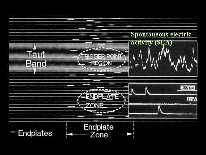 Spontaneous electric activity (SEA) 