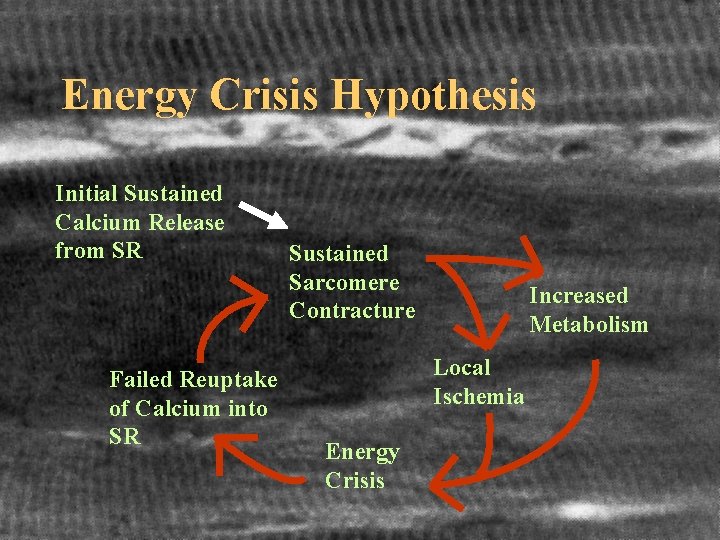 Energy Crisis Hypothesis Initial Sustained Calcium Release from SR Failed Reuptake of Calcium into